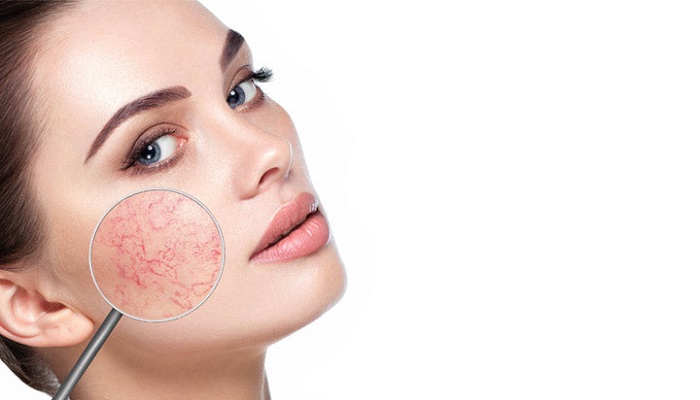 Do You Have Dry And Sensitive Skin? Learn The Causes And Treat It!